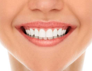 Diş beyazlatma Hakkında Bilgi