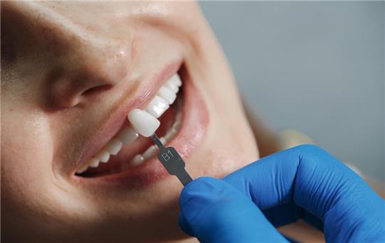 Dental Crown (Diş Kaplaması) Nedir? Ne Zaman ve Neden Gerekir?