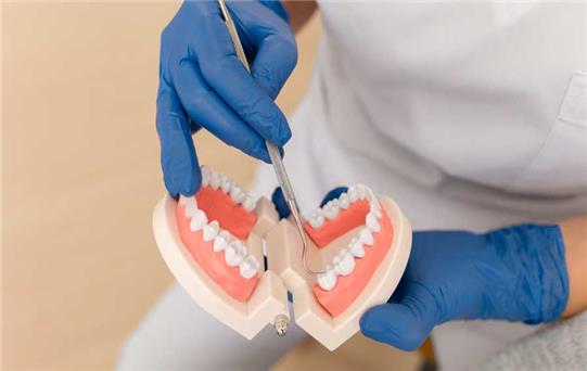Diş Protezleri: Gülüşünüzü Koruyan Etkili Çözüm