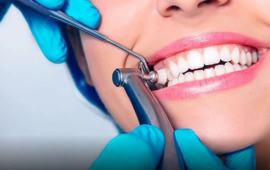 Diş Taşı Temizliği Fiyatları 2023 Hesaplama