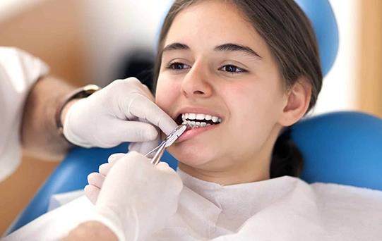 Diş Teli En Erken Kaç Yaşında Takılır?