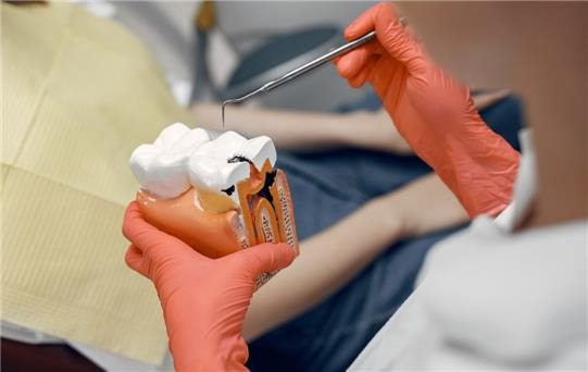 Endodonti (Kanal Tedavisi) Nedir ve Nasıl Yapılır?